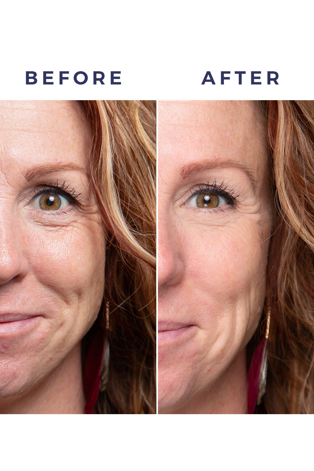Instant Action Wrinkle Smoother