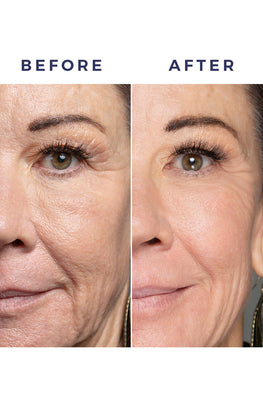 Instant Action Wrinkle Smoother