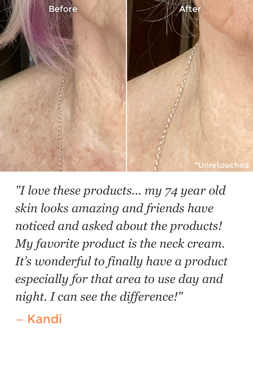 Neck Restoring Cream