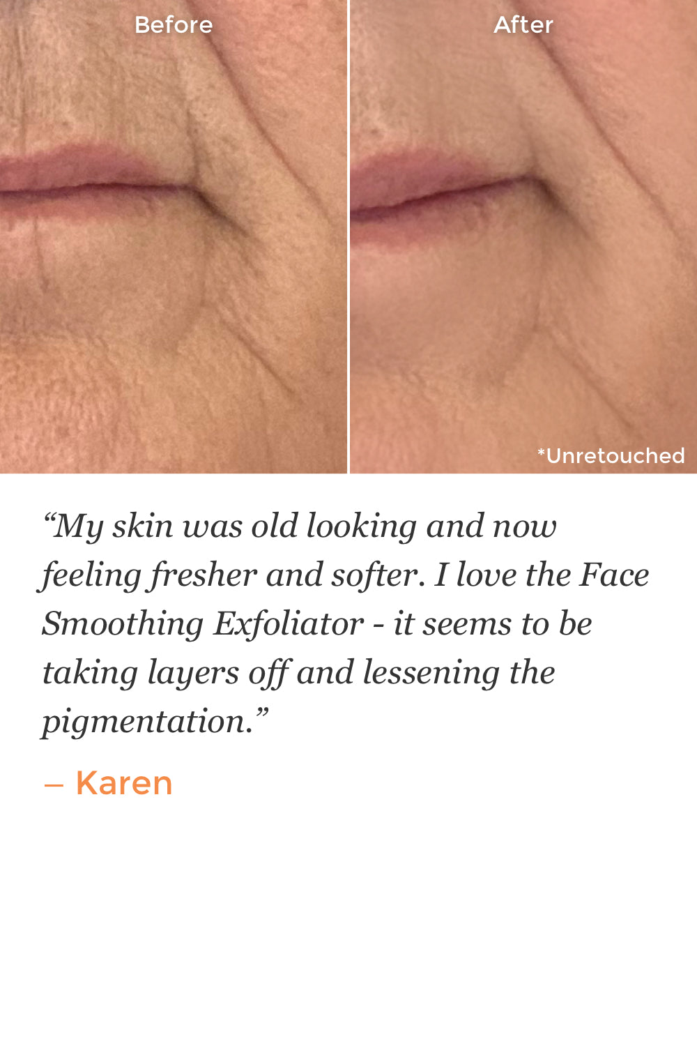 Wrinkle Recovery Serum