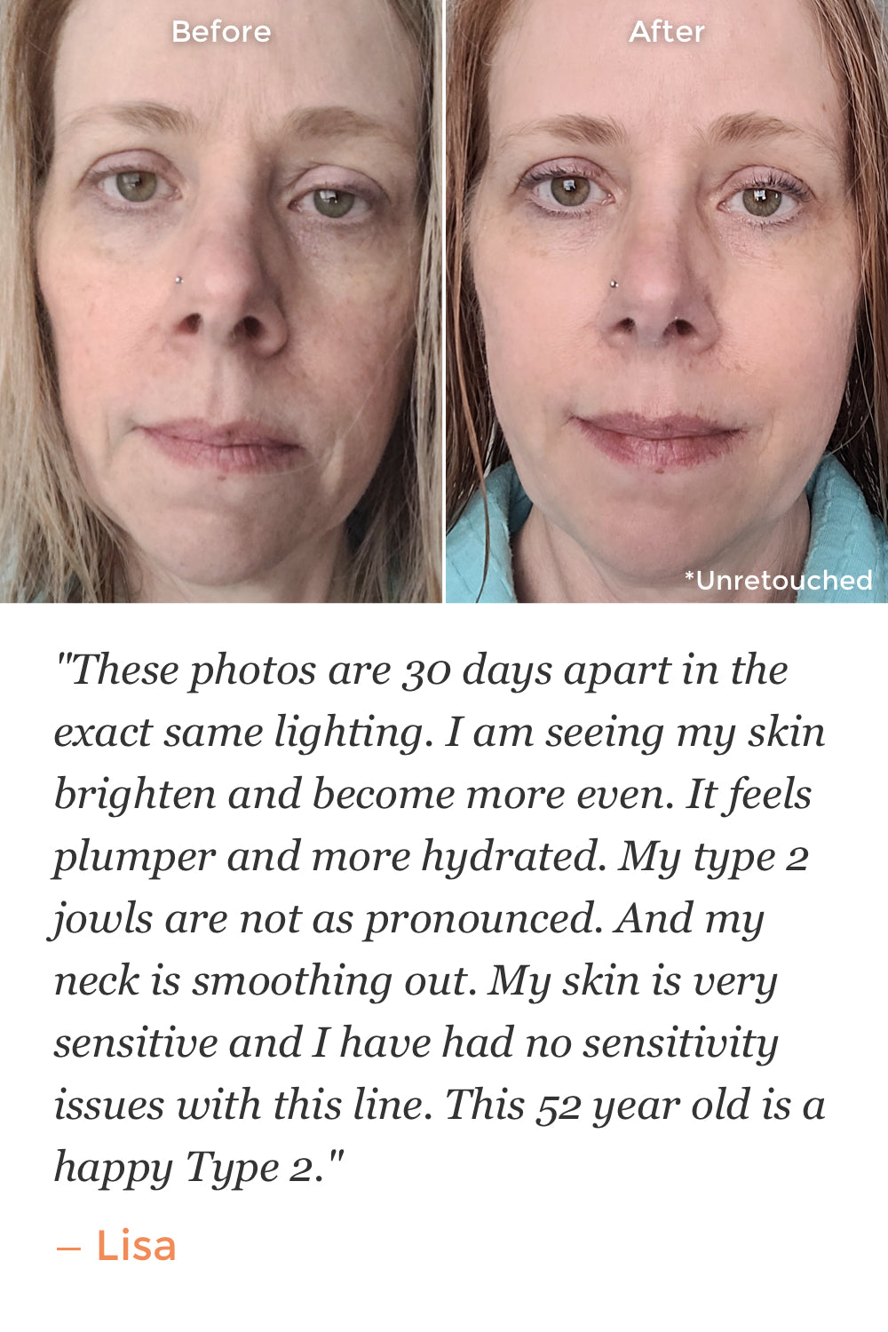 Skin Brightening Serum